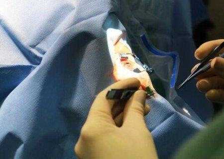 Tempo de espera por transplante de córnea no Brasil dobra em 10 anos