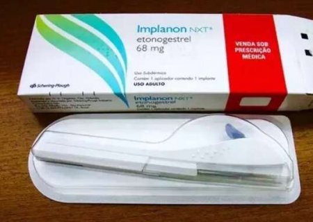 Implante contraceptivo deve ser ofertado por planos a partir de hoje